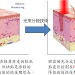 產後瘦後實例分享